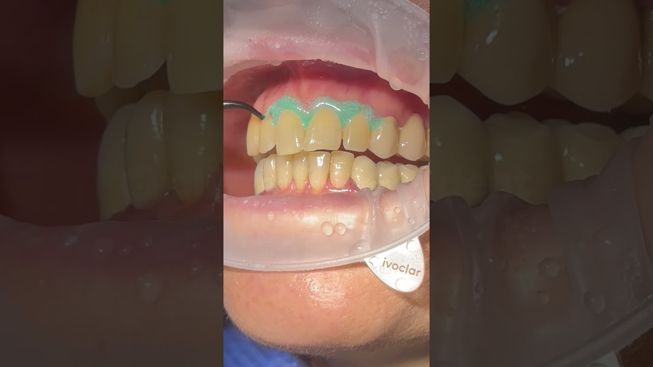 Clínicas dentales con planes de seguimiento semestral